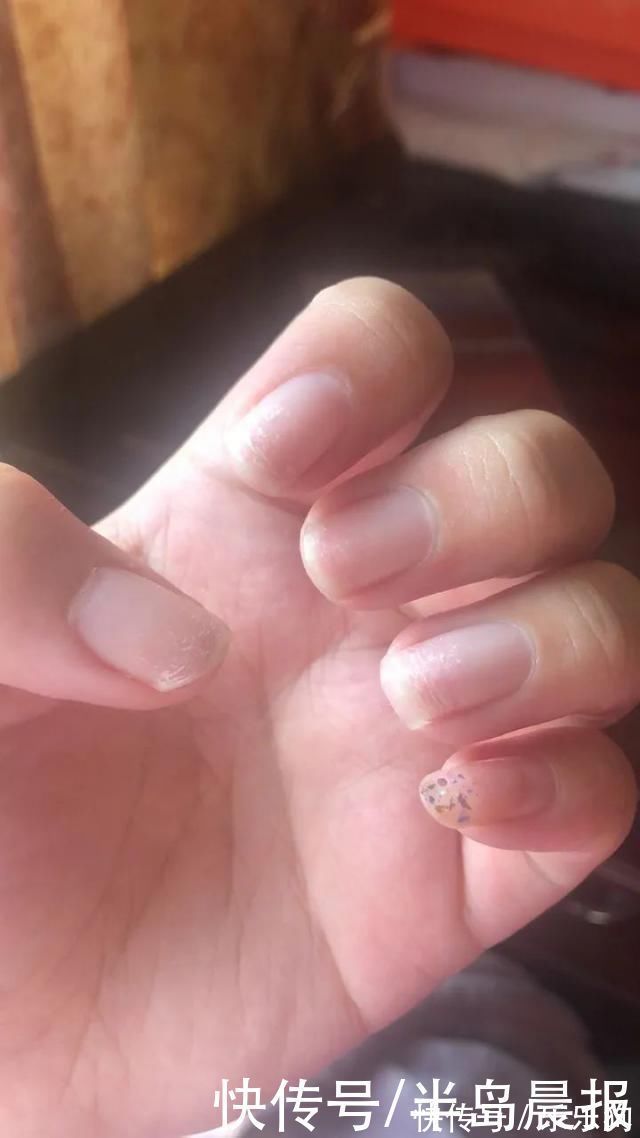 美甲|原本多好看的手,现在成这样了,姑娘:美甲做多的下场