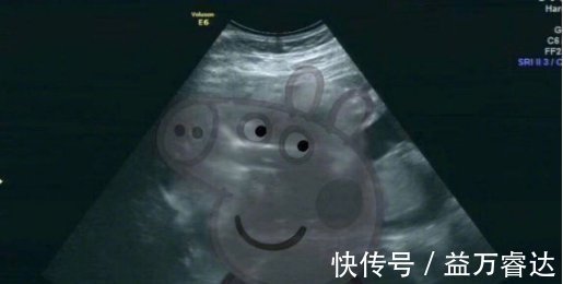 宝宝|孕24周B超检查,当看到宝宝的样子后,孕妈有些吓到了