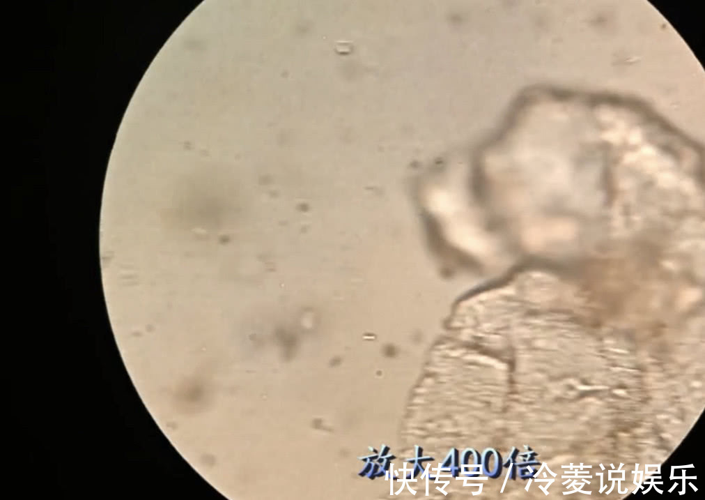 猪肉|猪肉冷冻3个月后还能吃吗放大1000倍,仿佛看到另一个世界