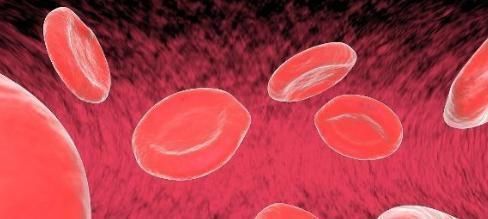 医生|吃大蒜能软化血管?医生:牢记4件事,血栓见你绕道走!