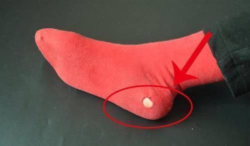 破洞|袜子上有破洞怎么办?教你一个诀窍,袜子变得完好如初,回家试试