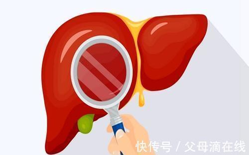 食物|72岁大爷降血脂30年,医生:2种食物是血脂“净化器”,可多吃