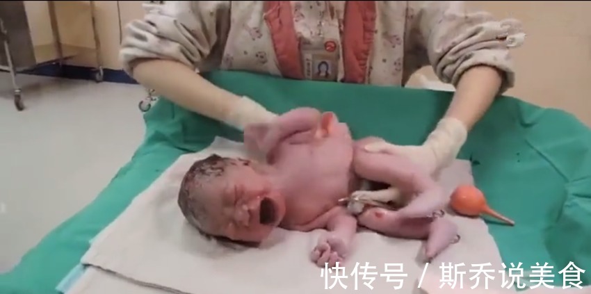 子宫|宝宝出生后被医生抱走的神秘十分钟都经历了什么看完真的萌到了