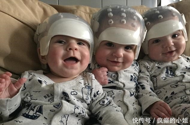 可爱的三个宝宝刚出生就“戴帽子”，摘下来的一幕让人心酸落泪