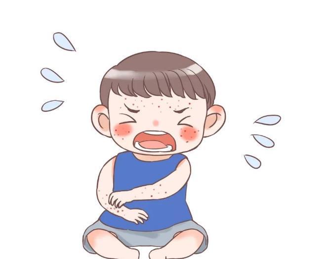 湿疹反复发作，危害不容小觑