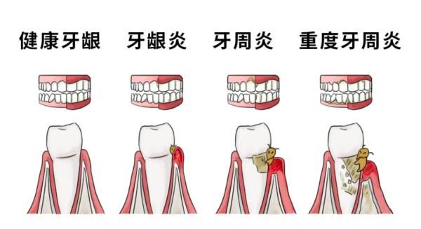 牙缝|原来就是这些误解，才让你不敢这么做！