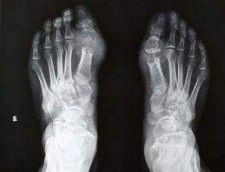 尿酸|7种碱性水果,每一个都是排尿酸高手,痛风的人要多吃些,了解下