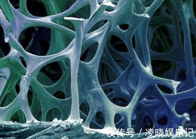 长寿|102岁老人,骨骼仅62岁,长寿秘诀不是多运动,而是这3件事