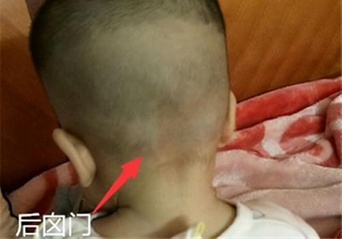 liu|宝宝卤门护理有多重要？如果出现这些情况，要尽快带娃去医院