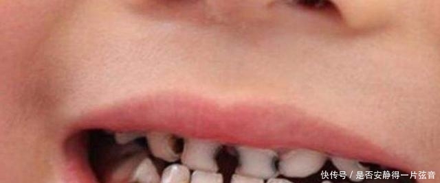 孩子|从小爱吃冷饮的孩子,和不爱吃冷饮的孩子,长大后的差距一目了然