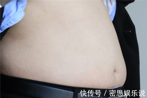 米饭|易长肉的主食有哪些？米饭不在内，正在减肥的人，尽量少吃