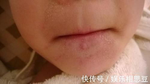 补充水分|母乳喂养的新生儿,喂水就没必要了吗?出现这些异常现象还是喂吧