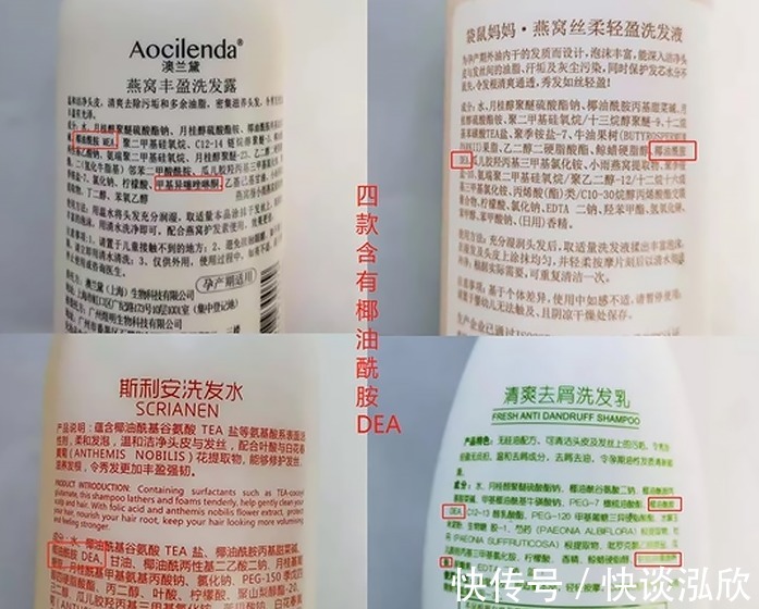 氨基酸|孕妈谨慎!被医生拉入黑名单的洗发水!孕妈该选宝藏级洗护看这里