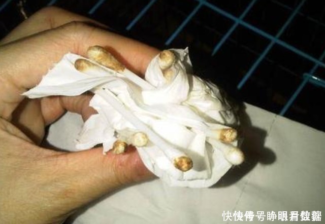 棉签|用棉签掏耳朵到底有多危险?3D动画演示,原理一目了然