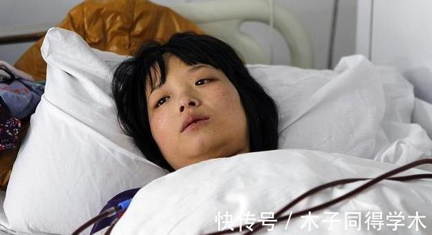 尿毒症|尿毒症可能吃出来的,不要贪吃三种食物,肾脏可能会感激你!