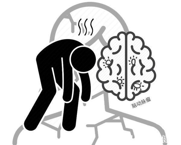 心脑血管|26岁女子经常夜班致2次脑出血:熬夜后,该如何进行“补救”?