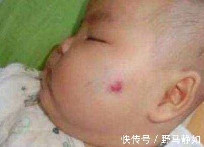 胎儿|怀孕期间,经常做这两件事的孕妈,胎儿容易长胎记,后悔都来不及