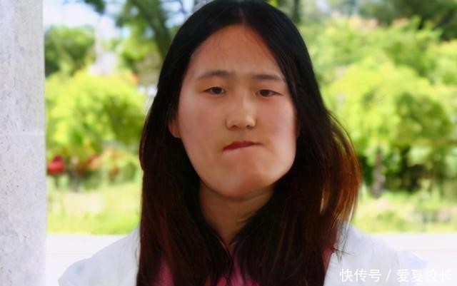 女神|“歪脸女孩”火了,受资助变身成女神,舍弃百万年薪赴西藏支教