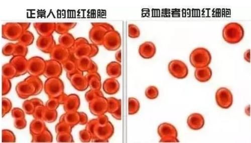 年龄|年龄越大，越要少吃肉？建议50岁后，2种肉不但要吃，还要多吃