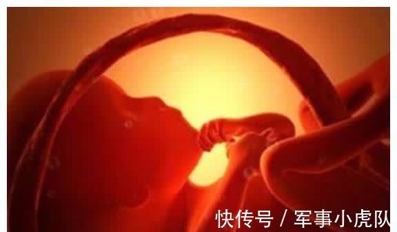 脐带|怀孕期间,孕妈要避免这三种行为,不然胎儿可能会“喘不过气”哦