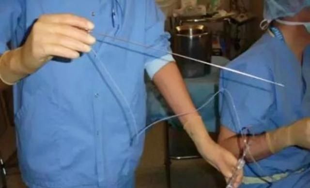 小编|做试管婴儿有多心酸90后宝妈表示试管很痛苦,想当妈真的很难