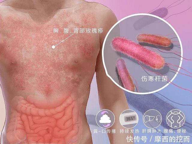 感染|正确使用筷子,关乎一家人的健康从选对、洗对、放对筷子开始