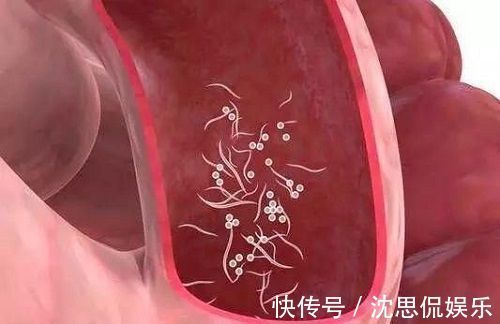 小月|3岁男孩总是“掏裆”，妈妈发现不对劲，检查后才知是“蛲虫病”