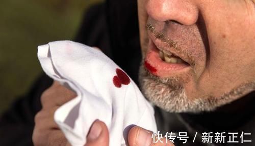 检查|身体出现这5种症状,或暗示你肺癌将至,趁早检查