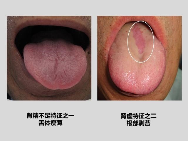 月牙|什么药补肾效果最好补肾良药哪家强,听听中医的建议,赛过牛鞭