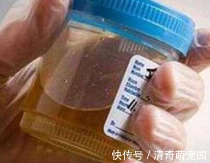 林医师|空腹血糖在这个范围内,要庆幸:你不是糖尿病候选人,要继续保持