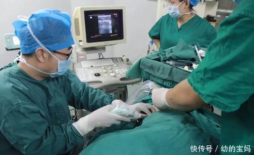 产妇们|剖腹产能有多“顺便”?有人要割脂肪,有人要结扎,最过分的是它