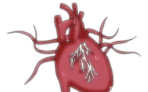 心脏支架才做了一年时间,就又堵了,是什么原因?