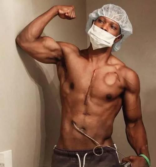 他没有心脏却仍坚持健身,美国27岁小伙感动全球