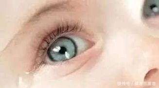 孩子|5岁宝宝眼睛“看不见了”,家人以为没睡好,检查后医生来晚了
