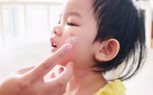 家长|儿科医生忠告：宝宝被蚊虫叮咬后，家长不要再这样做了