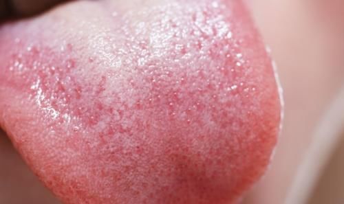 六味地黄丸|想要补肾?分不清是肾阴虚,肾阳虚,还是肾精虚?教你一招区分