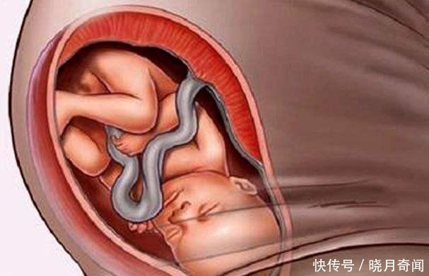 怀孕32周 孕妇耻骨疼痛 尿频加重是胎儿入盆了吗 会早产吗 快资讯