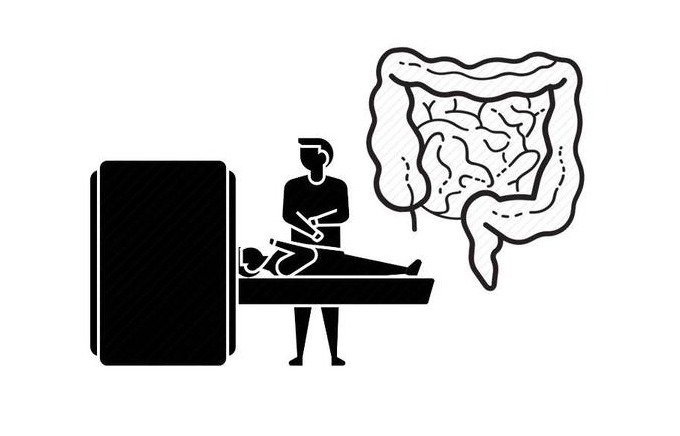 单发性|常见的肠道息肉类型,离不开这6种,但每一种都让人“不省心”