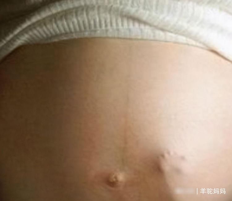 体力|孕期胎儿太“好动”，宝妈还调侃宝宝体力好，但医生却建议打掉