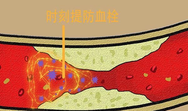 谷物类|体内血栓可以自动排出体外吗？哪些食物多吃点，或能清理血管垃圾