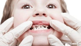 宝宝|宝宝的牙齿问题多又多,快来看看这几种解决方法吧