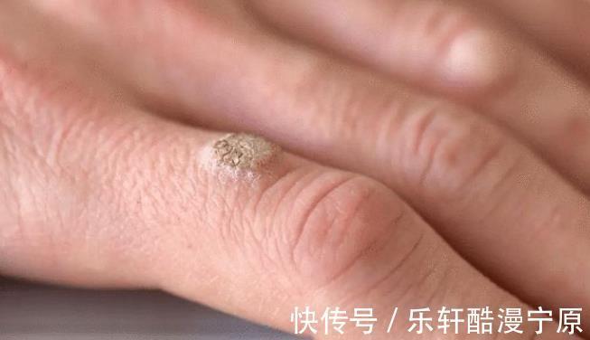 下身|女人身体2处“发痒”,注意是HPV来了,保护宫颈牢记这3点