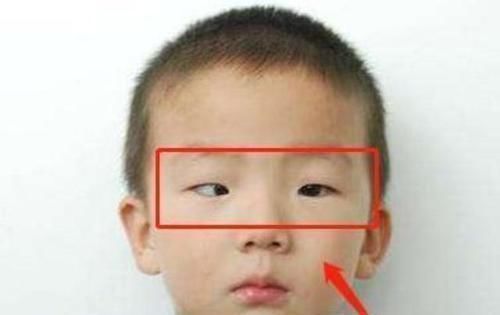 手机|5岁男童长期玩手机,黑眼珠逐渐“消失”,医生很难恢复