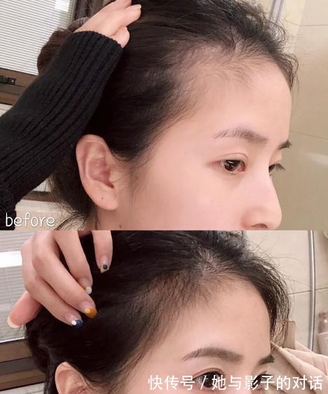 发质|网红洗发水测评资生堂头皮痒,阿道夫太香,第4个防脱发效果好!
