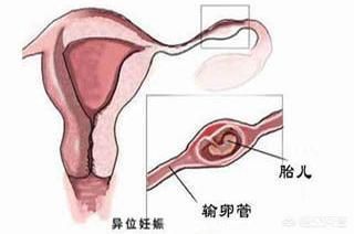 检查|为什么怀孕不到3个月,医生还让我做B超检查,有什么意义?