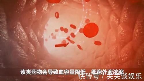 地平类药物|高血压合并高尿酸,常用降压药成“真凶”,用对1种药不患痛风