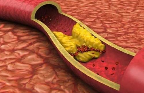 年龄|年龄越大，越要少吃肉？建议50岁后，2种肉不但要吃，还要多吃