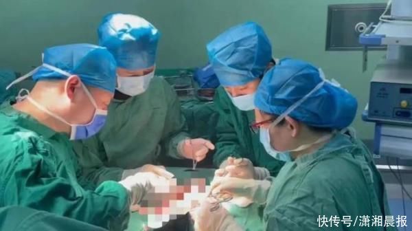 河南一女子整个右手绞入绞肉机，手术团队接力18小时重建碎手