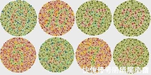 血友病血友病|母亲有这3种遗传病,只“传男不传女”,如果有希望你能生女儿