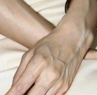 手上青筋越多，说明身体是好是坏青筋究竟是怎么回事